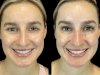 First-Time at the Best Aesthetic Clinic in Dubai? Here’s What to Know Before You Go