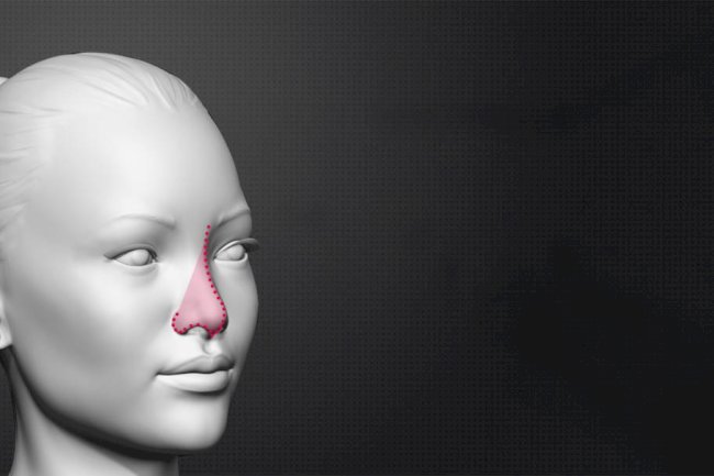 Common Fears About Facial Feminization Surgery