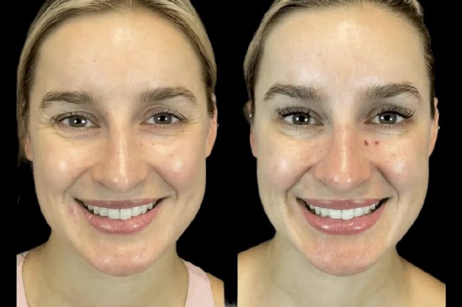 First-Time at the Best Aesthetic Clinic in Dubai? Here’s What to Know Before You Go