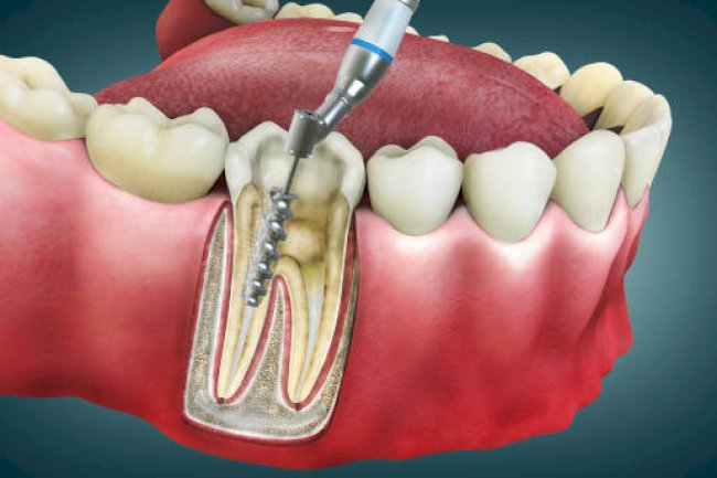 Dentist in Mumbai: Your Guide to Expert Dental Care