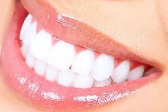 How Much Does a Bright Smile Teeth whitening Cost?