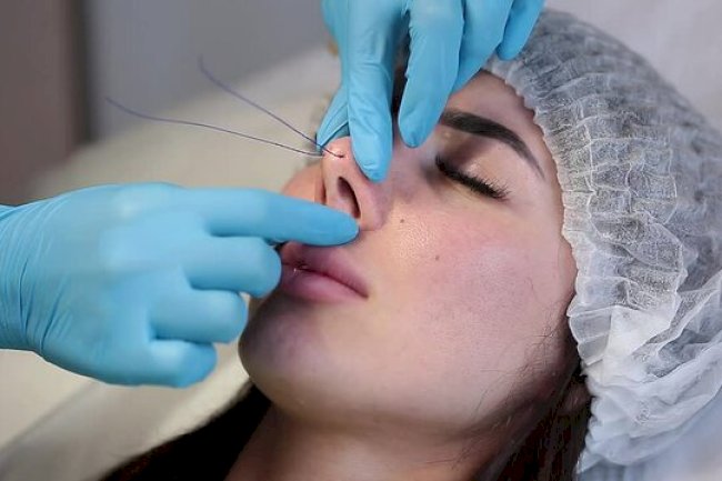 Is Non-Surgical Rhinoplasty Worth It Long-Term?