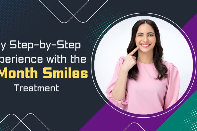 My Step-by-Step Experience with the 6 Month Smiles Treatment