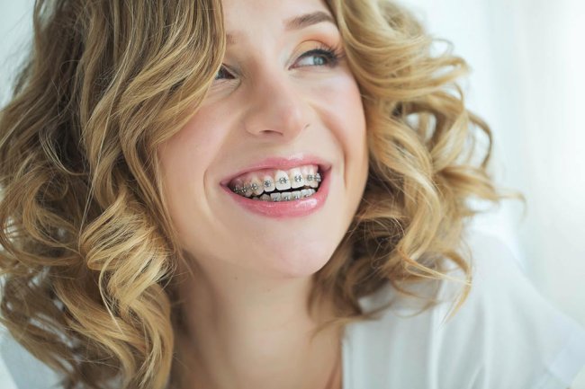 How Do Invisalign and Braces Orthodontics Compare for Treatment?