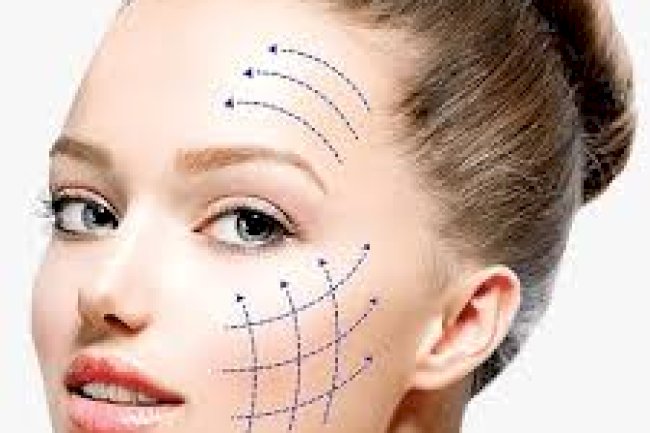 Common Concerns About Thread Lift in Islamabad