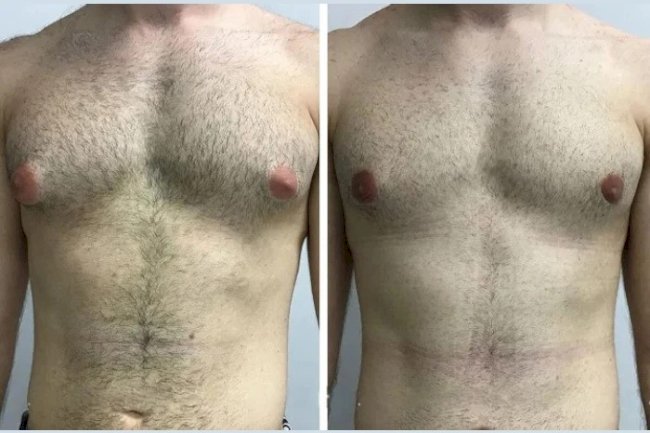 Fitness Regimen Recommended by Best Doctors in Dubai Post-Surgery