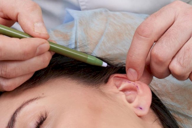 Latest Advancements in Ear Reshaping in Islamabad
