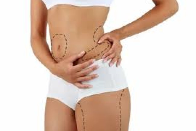Transform Your Body: Real Liposuction Results from Islamabad Clinics
