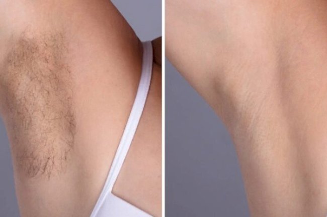 Best Aesthetic Clinics in Dubai Offering Advanced Electrolysis Laser hair removal