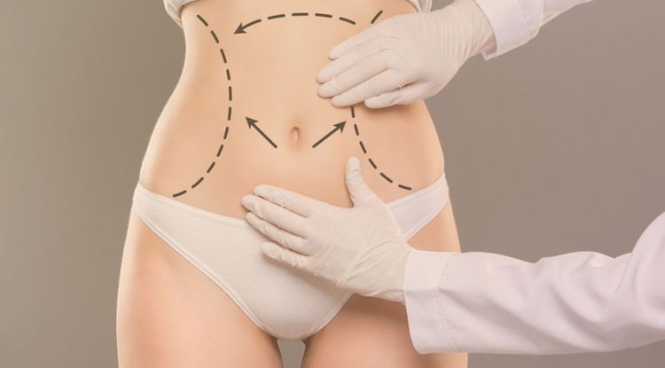 How to Combine Tummy Tuck with Weight Management in Islamabad