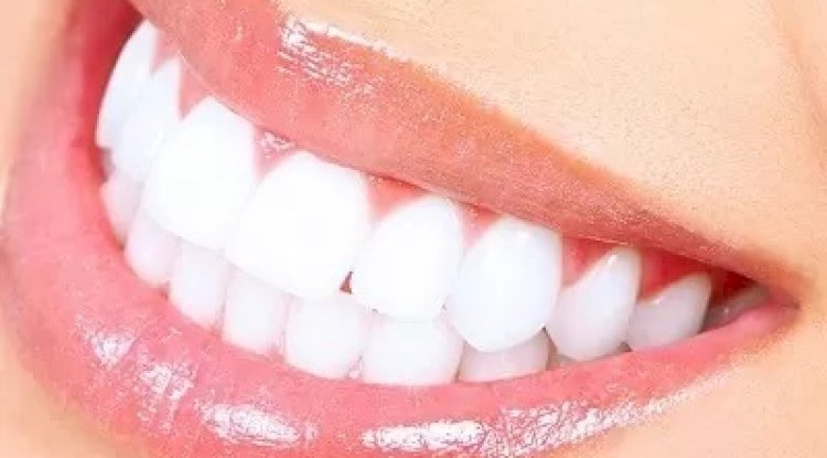 What Whitening Tools Are Actually Cost-Effective?