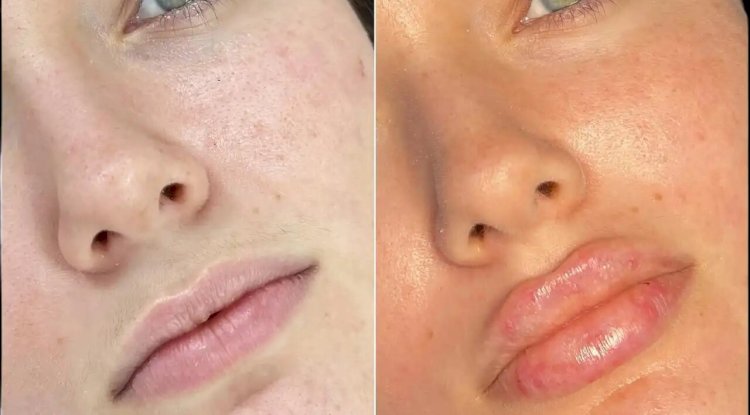 Best Plastic Surgeon in dubai for Fillers: How to Identify Genuine Reviews
