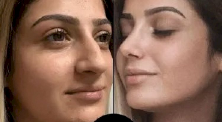 Top 10 Best Aesthetic Clinics in Dubai for Skin and Beauty