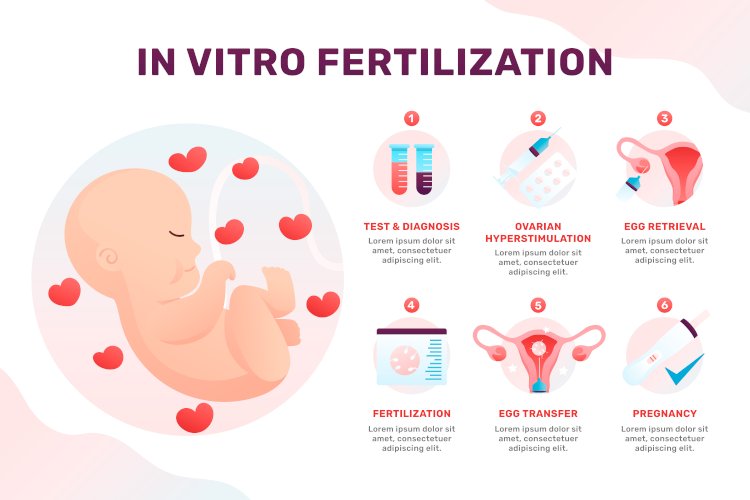Best IVF Doctor in Delhi – Your Guide to Trusted Fertility Care
