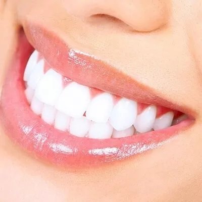 How Much Does a Bright Smile Teeth whitening Cost?