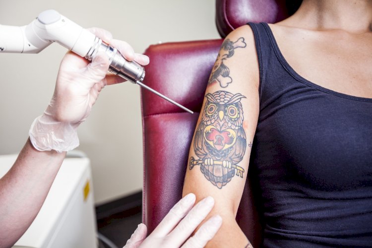 How PicoSure Laser Works: The Science Behind Tattoo Removal
