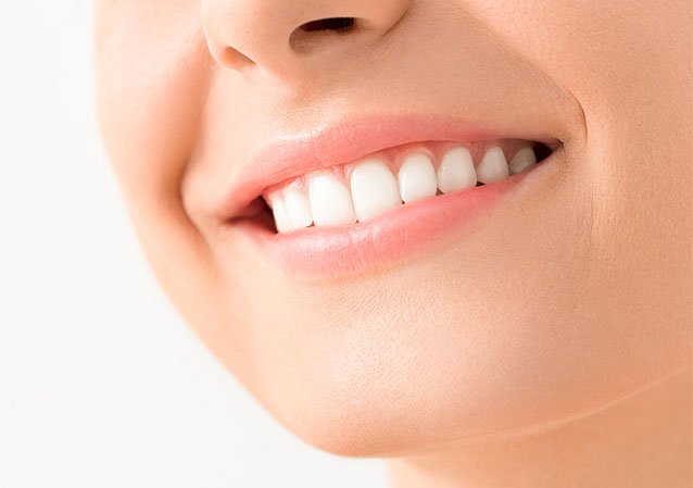 How Teeth Whitening Cost Matches Expectations