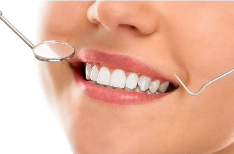 Teeth Whitening Treatments That Work in Dubai