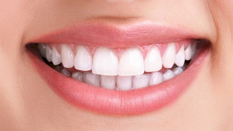 Teeth Whitening Cost: Is It Cheaper With Insurance?