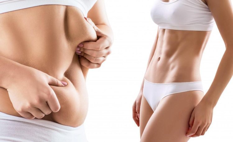 Essential Advice from the Best Liposuction Surgeon in Dubai