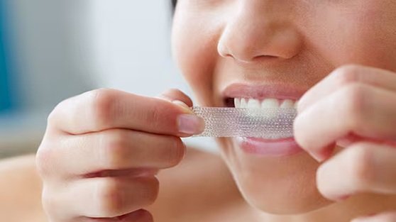 Smile Brighter Every Day: The Power of Crest 3D Whitestrips