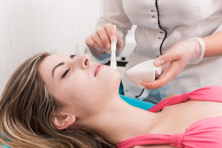 Chemical Peels in Islamabad: Success Stories