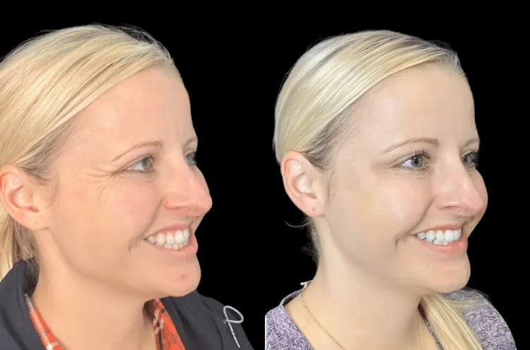 What Makes the Best Aesthetic Clinic in Dubai Ideal for Personalized Care