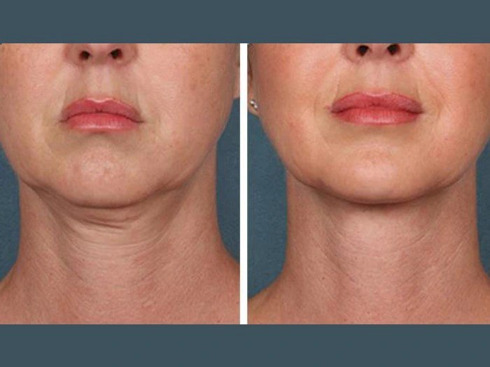 Best Plastic Surgeons in Dubai Recommended for PRP Treatment